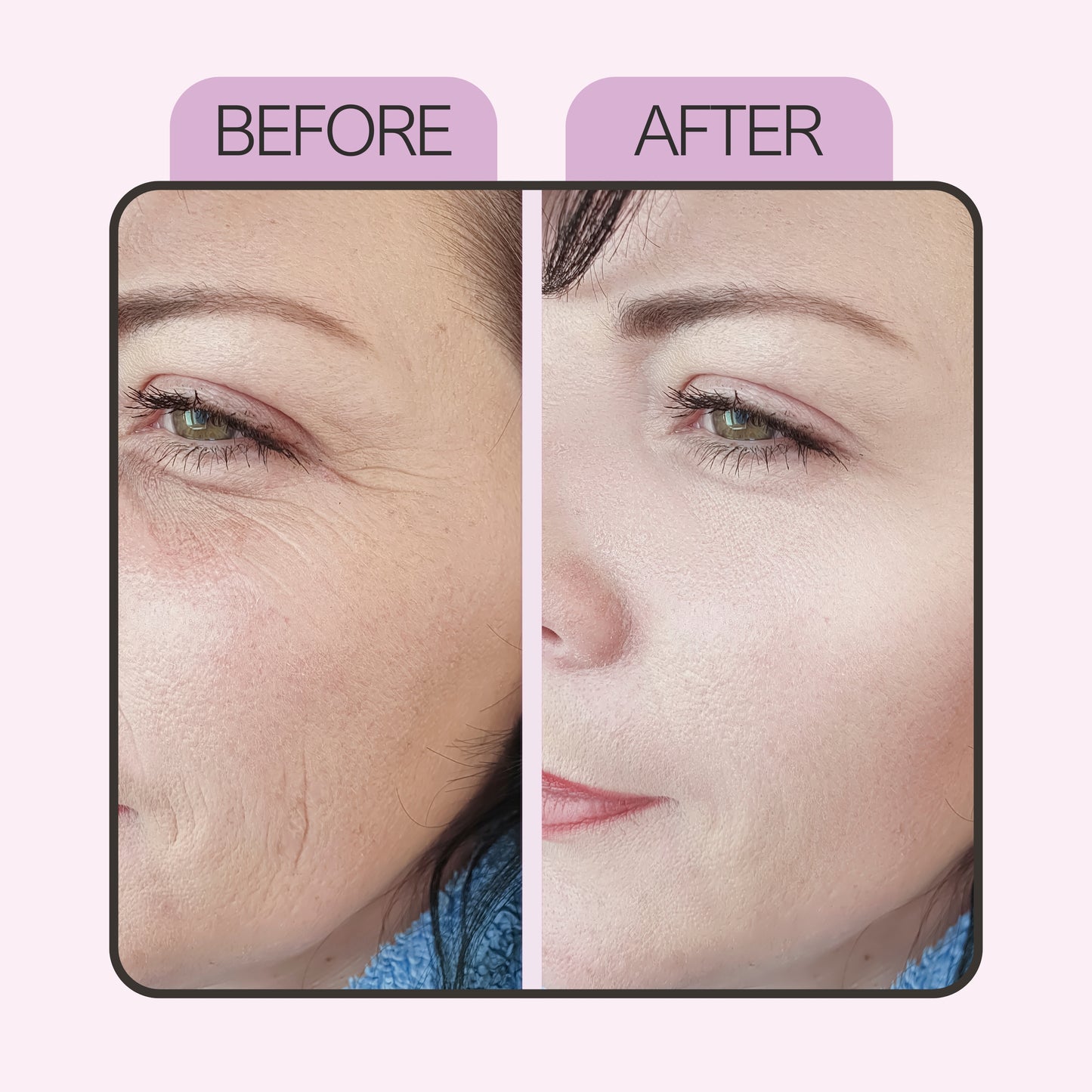 Anti Aging Face Serum with 2% Hyaluronic, 2% Alpha Arbutin, 10% Niacinamide Acid & Peptides For Wrinkles, Hydration, Skin Glow & Elasticity