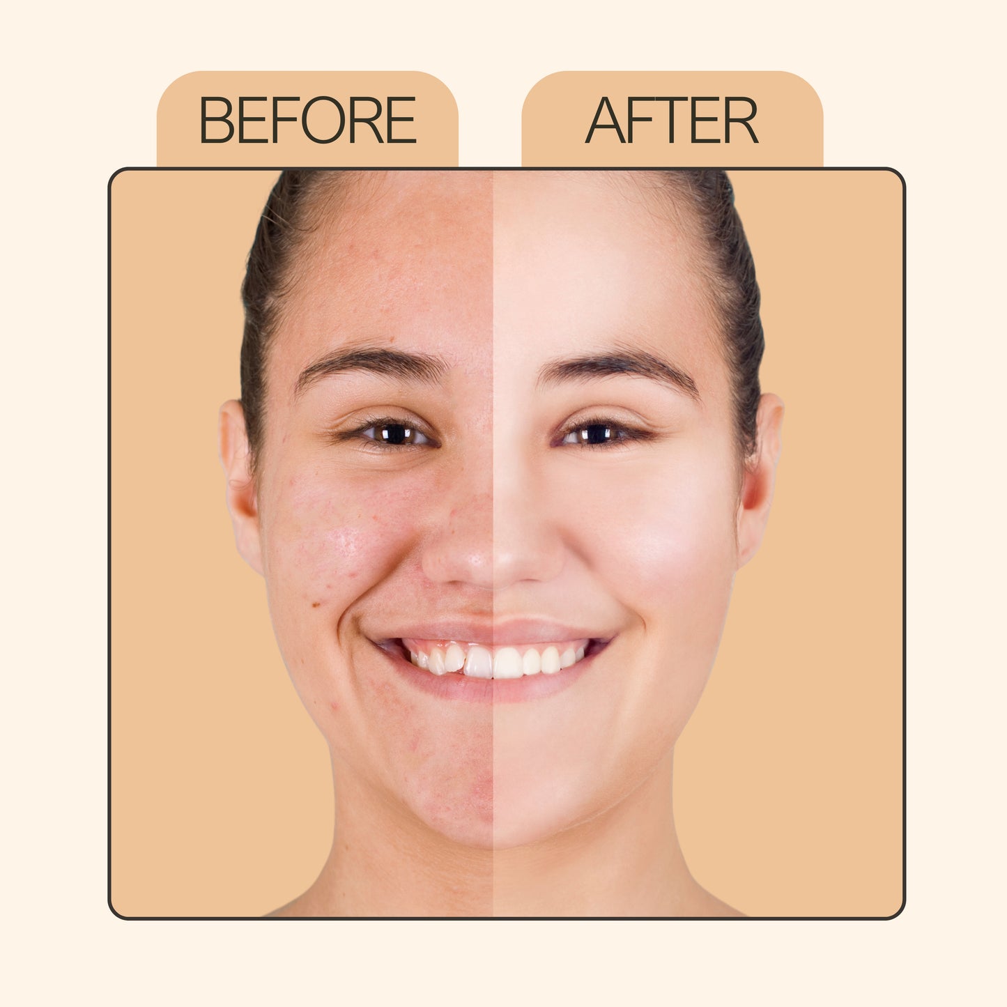 Vitamin C Glow Kit – Full Size 30ml + Free Travel Mini 10ml | For Dull, Uneven Skin Tone | Radiant Skin Care | Antioxidant Boost & Tan Reduction (Set of 2)